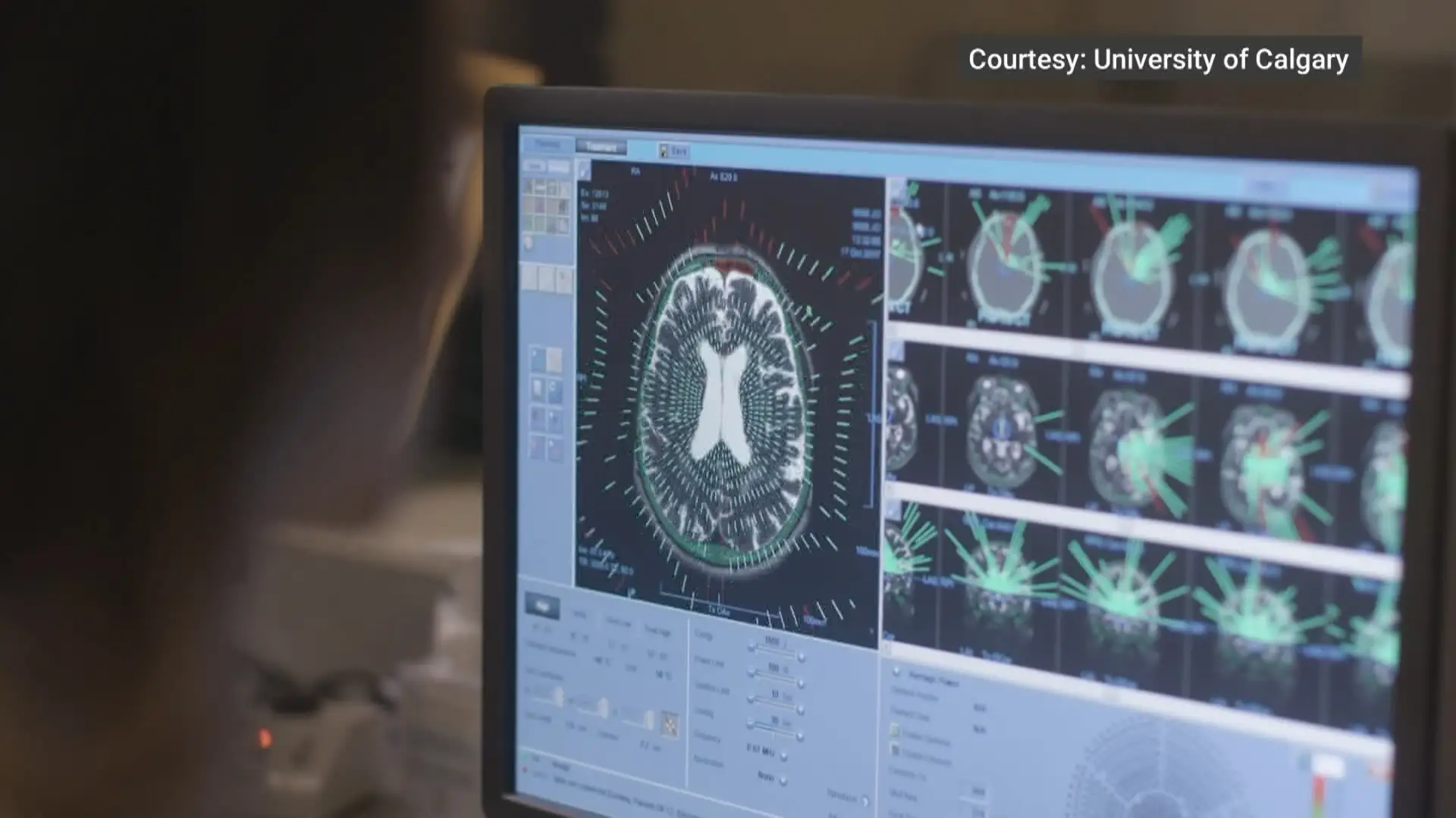 From Grassroots Kindness to Breakthrough Research: How One Calgary Man's Legacy Is Transforming Mental Health Care